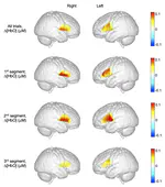 Consistency of children’s hemodynamic responses during spontaneous speech